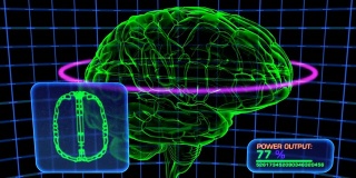 脑扫描计算机显示模拟，高清元素