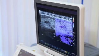 医学。监视器上的超声波图像。视频素材模板下载