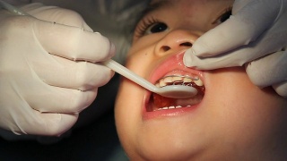 牙医小心翼翼地反复调整亚洲宝宝的牙套。视频素材模板下载
