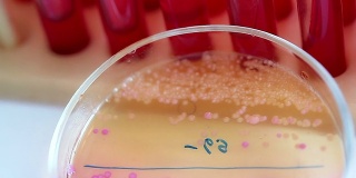 科学实验室。培养皿中的细菌菌落