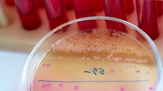 科学实验室。培养皿中的细菌菌落视频素材模板下载