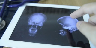 Doctors Examining X-Ray Image On A Tablet