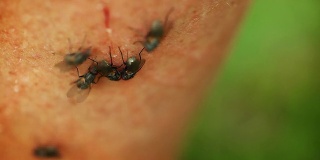 苍蝇以皮肤上的小伤口为食