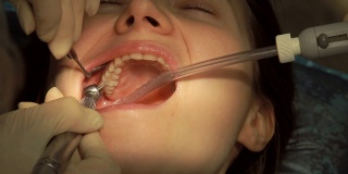 牙科医生和助手补牙
