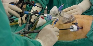 HD DOLLY : Endoscopic surgery