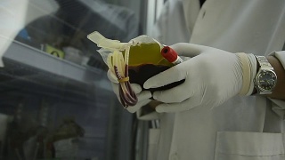 亚洲医疗技术员在实验室医院进行血袋冷藏期间的质量控制视频素材模板下载