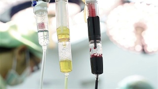 医生给予静脉输液，包装红血球和新鲜冷冻视频素材模板下载
