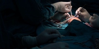 血管外科医生确定了头静脉和桡动脉