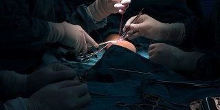 血管外科医生确定了头静脉和桡动脉