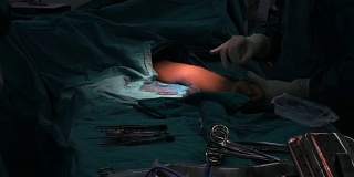 手术结束后，助理外科医生闭合手术伤口