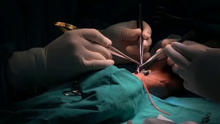 血管外科缝合吻合视频素材模板下载