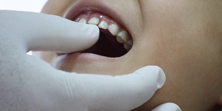 牙医检查小女孩的牙齿用手套摆动松动的牙齿