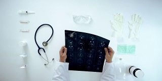 医务人员在头顶角度检查x光片