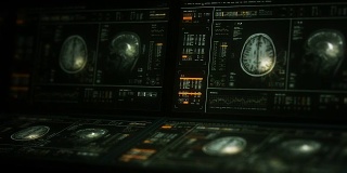 核磁共振脑部扫描电脑