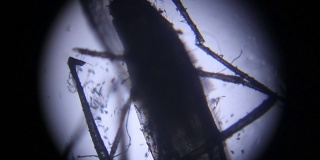 显微镜下观察雌蚊