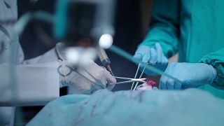 外科医生操作。麻醉过程。医疗操作。手术团队工作视频素材模板下载