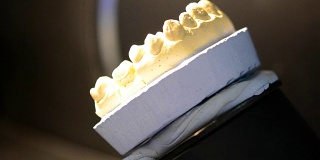 3D扫描人类牙齿模型的特写