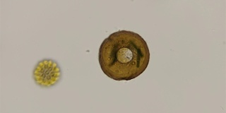显微镜下的变形虫
