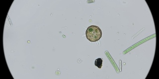 在显微镜下观察gibbosa阿赛拉变形虫的状态