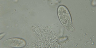单细胞动物(滴虫)在显微镜下的运动。在湖水中显微镜下观察的纤毛虫柱头藻群落。关闭了。UHD 4 k