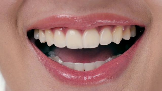 微笑女人的特写。牙科检查