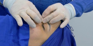 外科医生完成女性患者鼻中隔偏曲鼻整形手术后。