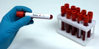 疟疾检测阴性医生提供血样实验室研究保健