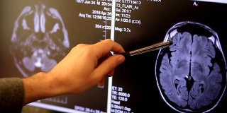 医生看着电脑屏幕，病人在mri机器中移动，医生在他的笔记本电脑上分析磁共振成像的结果。
