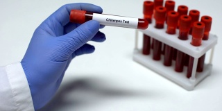 水痘，医生在试管中展示血液样本，实验室研究，健康检查