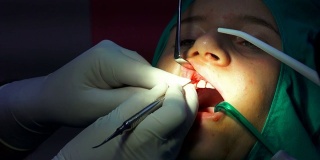 口腔外科手术，cist根尖切除术，暗室手术