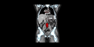 医学MRI影像筛检，CT或CAT扫描仪