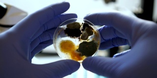 科学家在细菌培养中进行分析。特写镜头。化学实验室细菌培养皿。手拿蓝色手套的培养皿与霉菌和细菌菌落。科学专业嫁接细菌。