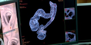 腹部的腹腔镜成像和计算机研究