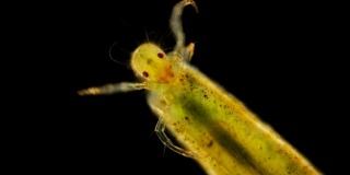 毛翅目幼虫的显微镜观察