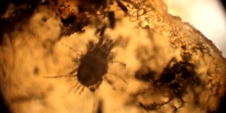 微生物在苹果的霉菌上移动。在显微镜下观察。