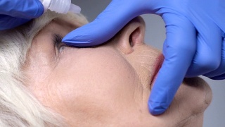 在手术前，眼科医生将药物滴入成熟女性的眼睛视频素材模板下载