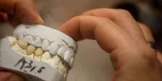 牙科技术员正在制作假牙