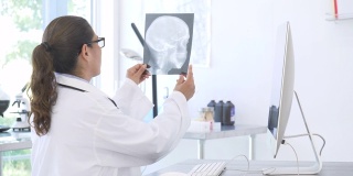 医学专家在电脑上回顾x射线