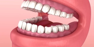 智齿的问题。医学上准确的牙齿3D动画