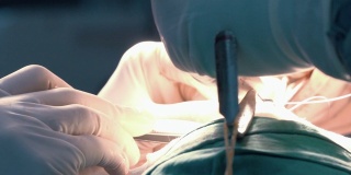 外科医生在鼻整形手术中缝合的特写