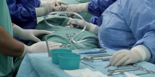CU外科手术在手术台上进行手术。