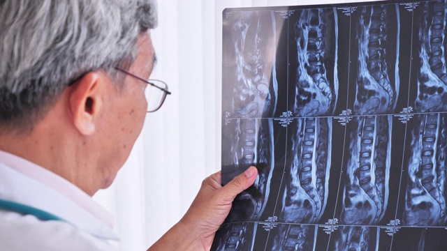 亚洲资深男医生正在深入分析x光片的治疗效果。