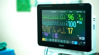 手术室4K心脏监护仪。心电监护仪显示患者的心率背景视频素材模板下载