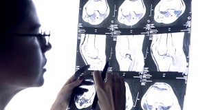 医生通过关节的x光片检查。关节的MRI快照。