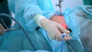 腹腔镜手术一个人腹腔内的腹腔镜手术视频素材模板下载