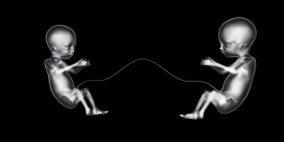 双胞胎小新生儿婴儿的X射线概念未来，3D动画。4 k