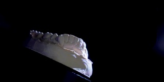 牙科修复恢复。牙科医生正在为雕刻的塑料假牙制作3D模型与高科技数字扫描设备。3 d齿扫描