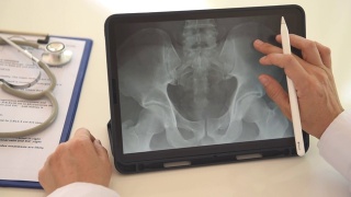 脊椎腰椎x线扫描视频素材模板下载