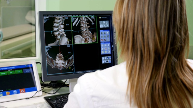 医疗保健的概念。医院医生正在看CT扫描。在肩膀上方拍摄的女性医学科学家与扫描图像上的个人电脑在实验室。神经学研究中心。高清