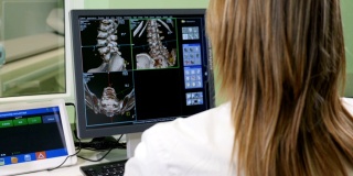 医疗保健的概念。医院医生正在看CT扫描。在肩膀上方拍摄的女性医学科学家与扫描图像上的个人电脑在实验室。神经学研究中心。高清